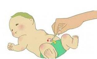 新生儿肚脐眼怎么消毒擦拭,婴儿肚脐眼需要消毒吗