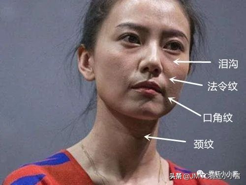 25岁抗老拯救垮脸,哪种脸型抗衰抗皱