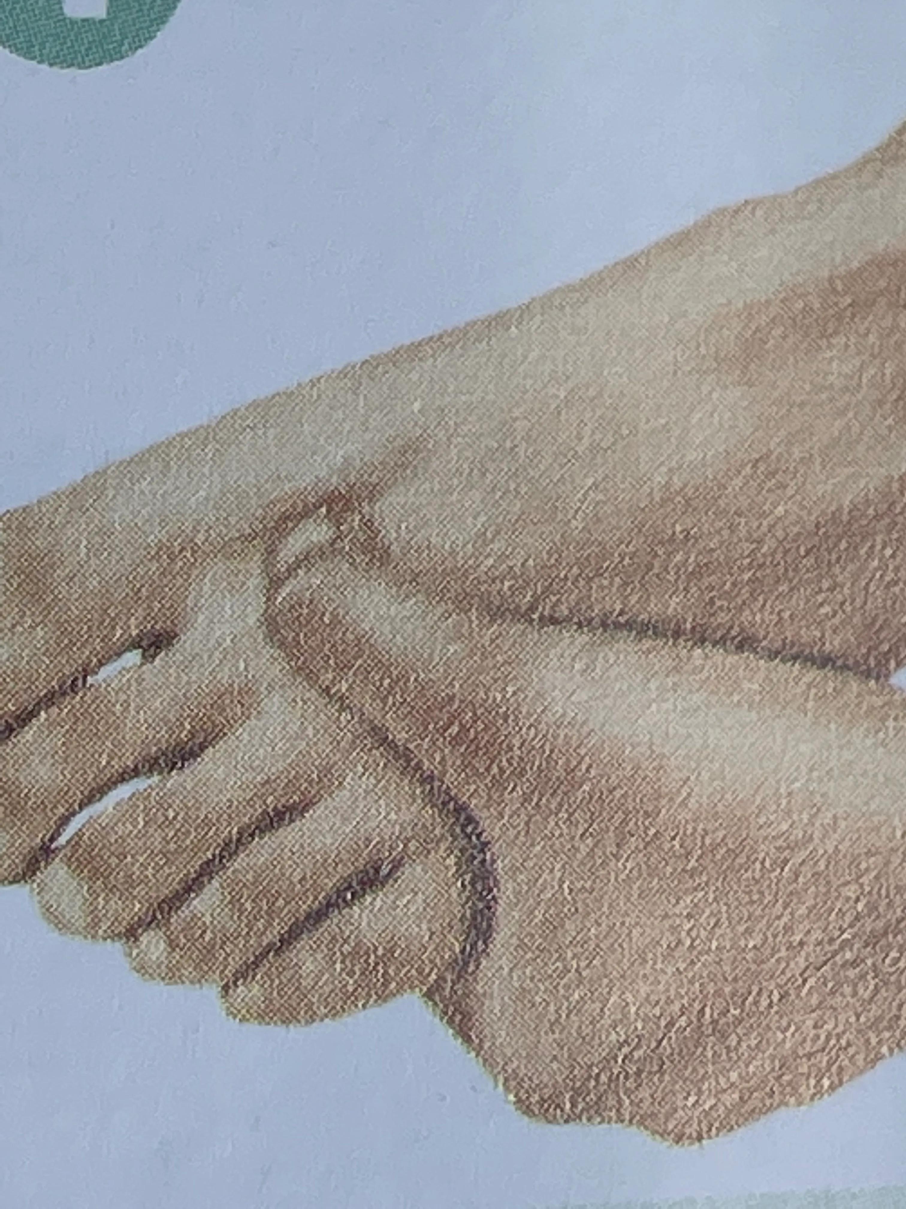 乳腺增生结节怎么办啊,乳腺增生结节怎么办呢