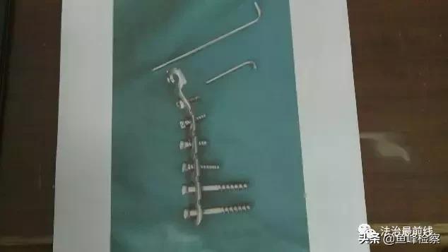 女子骨折术后,骨折术后复查发现钢钉有错位