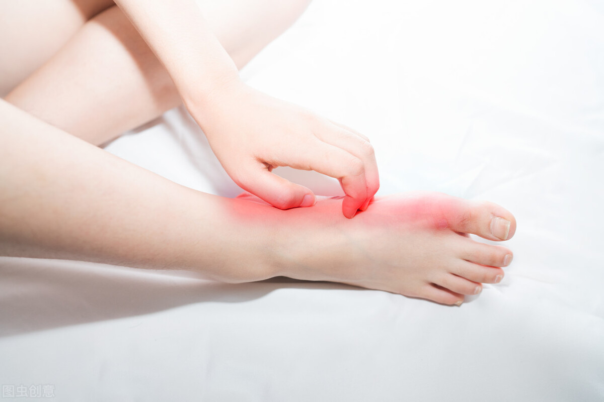 脚气脱皮瘙痒,脚有脚气脱皮又痒怎么办