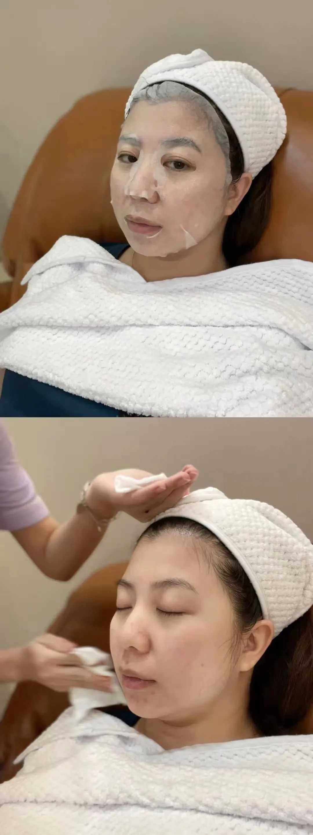 有没有免费做的医美项目,医美项目亲身经历