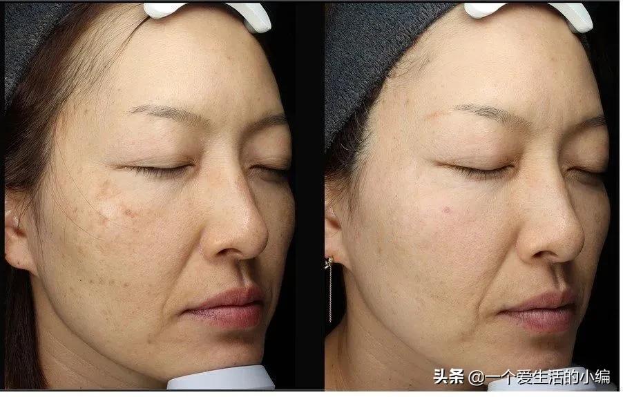 日本女孩长不胖的秘密,日本女人为何不长斑