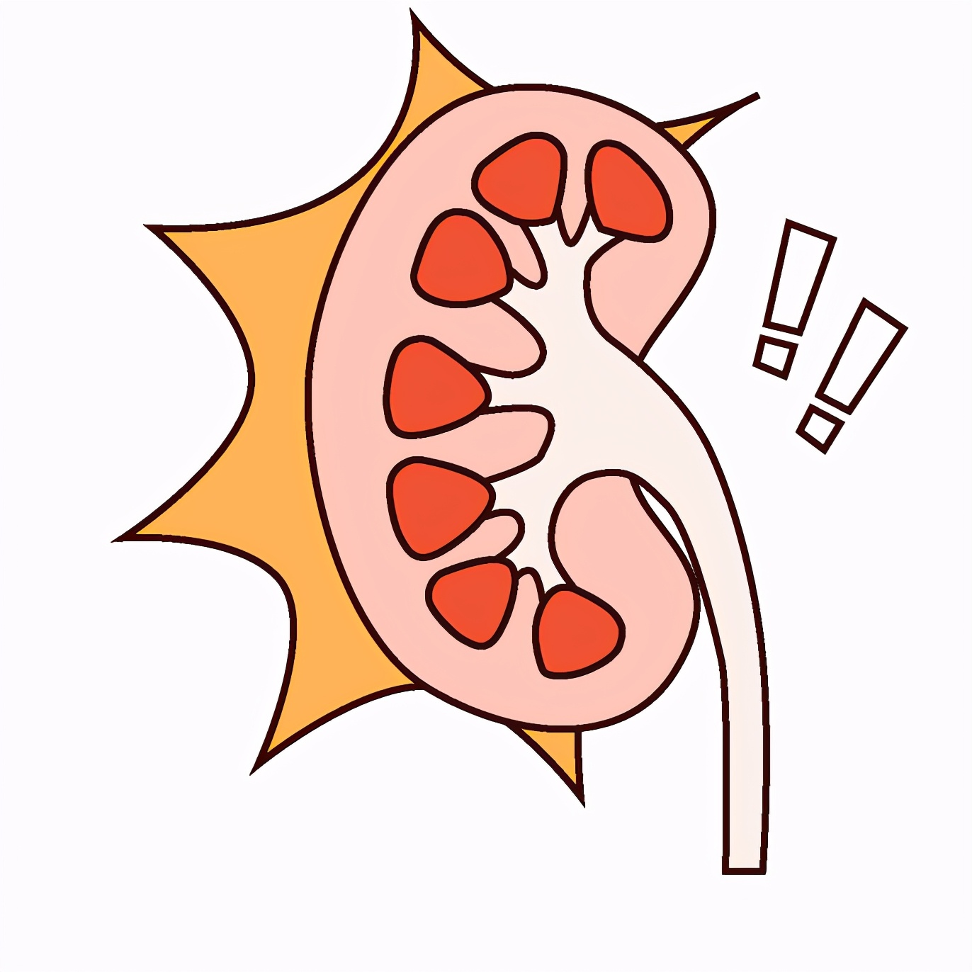 体外碎石和激光的副作用和危害,输尿管结石超声波碎石后的副作用