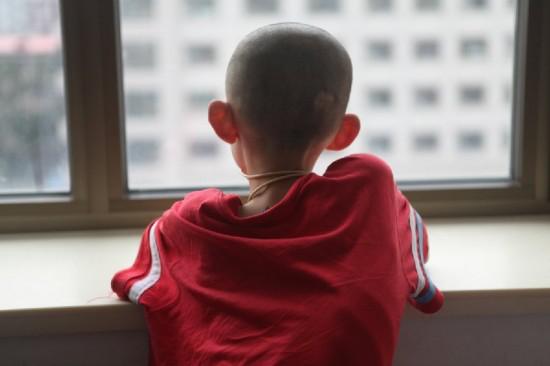 黑毛痣做了激光还会恶化吗,黑毛痣上毛发脱落一定是恶化吗