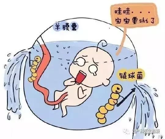 怀孕生孩子那些事,做什么检查可以知道胎膜早破