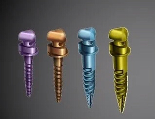 矫正牙齿在牙龈打钉子多久能取,整牙一定要在牙龈里打钉子吗