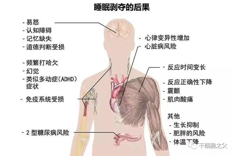 挽救3亿失眠患者，干细胞疗效持续长达1年之久，远高于药物治疗