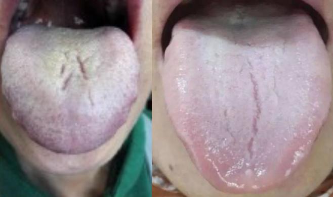 肾阴虚和肾阳虚的表现和区别,肾阴虚和肾阳虚怎么正确判断