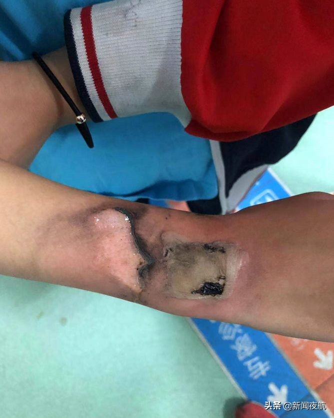 紧急提醒孩子带什么东西,紧急提醒孩子天天戴什么