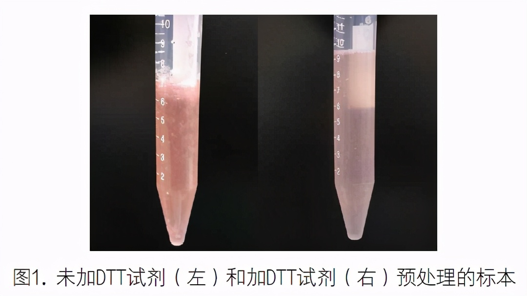支气管肺泡灌洗液检测技术规范,肺泡灌洗液肿瘤细胞检查准确性