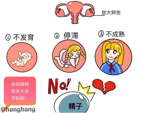 不孕不育漫画解说,不孕不育漫画