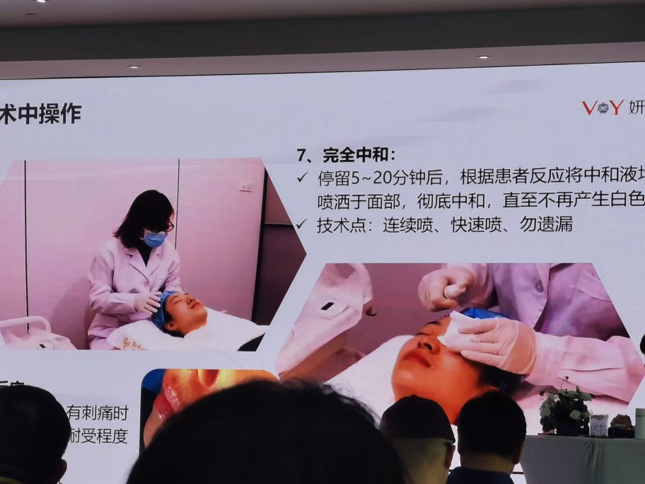 果酸脸部换肤,果酸化学换肤