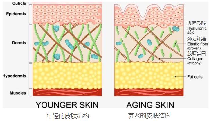 25岁眼角纹严重怎么办能补救吗,25岁眼下细纹怎么去除