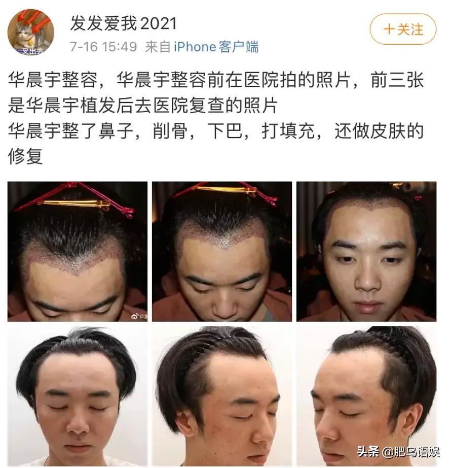 女网友晒浴照，曝光华晨宇出轨！张碧晨是小三？热搜却只有整容