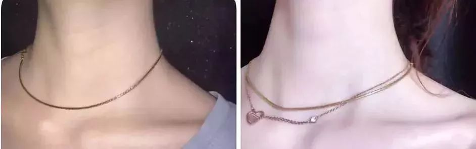 张韶涵如何抗糖,张韶涵抗老秘密