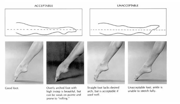 芭蕾脚背有多可怕,练芭蕾对足弓会受影响吗