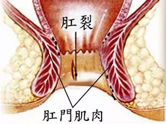怎么判断自己是否有hpv,怎么判断自己是否有耳结石