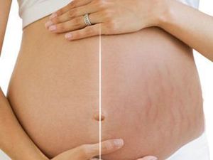 涓尰淇濆吇鐨偆,濂藉ソ淇濆吇鐨偆