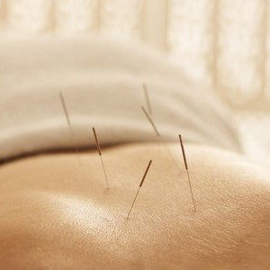 针灸皮质醇,如何降低体内皮质醇