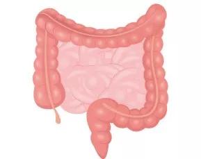 小肠淋巴管扩张症怎么回事,小肠淋巴管扩张症有什么症状