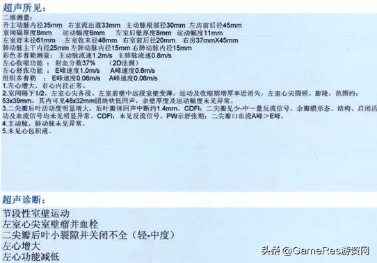 突破能力瓶颈,用一套游戏设计方*论法**从“熟练工”进化为“专家”