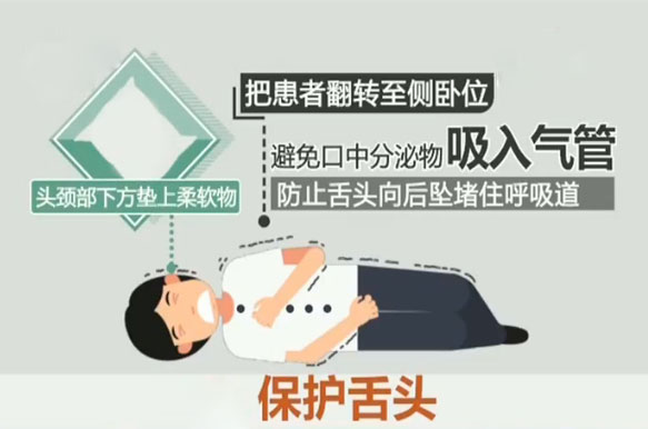 应对癫痫患者犯病的正确处理方式,癫痫持续状态抢救教学视频