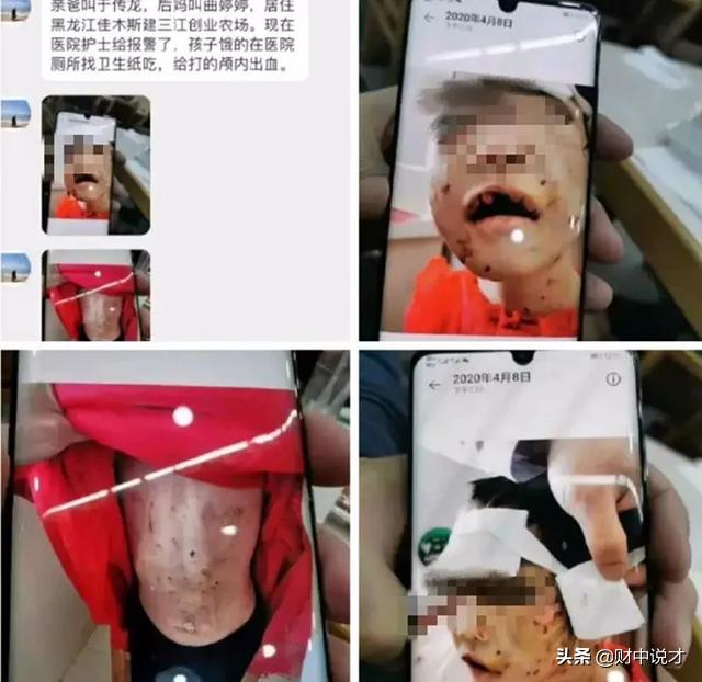 3岁孩子被打进icu后续,icu不为人知的秘密