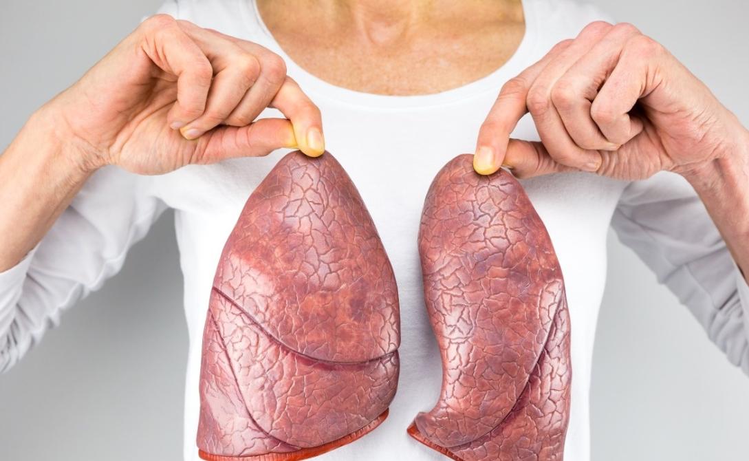 揭开“肺腺癌”的神秘面纱，同癌症交手，不能被束手就擒