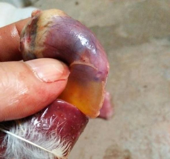 安卡拉病心包积液图片,心脏出血引起的心包积液