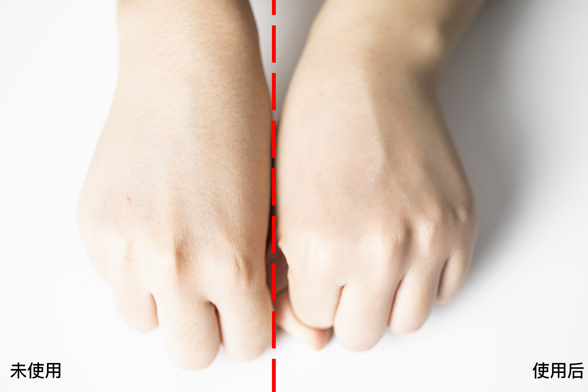 解决黑头的2种药,解决黑头的最好方法