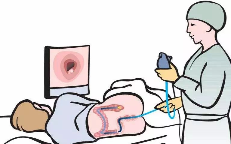 肠镜内镜检查全过程,带你了解胃肠镜全过程