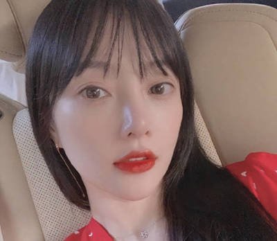 女人打玻尿酸的表现,女人经常打玻尿酸10年