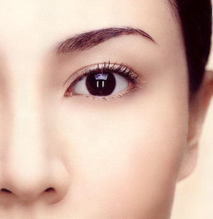 各种双眼皮类型,四种公认最丑双眼皮