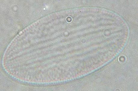 水产养殖藻类老化是怎样的,水产养殖显微镜下各种藻类