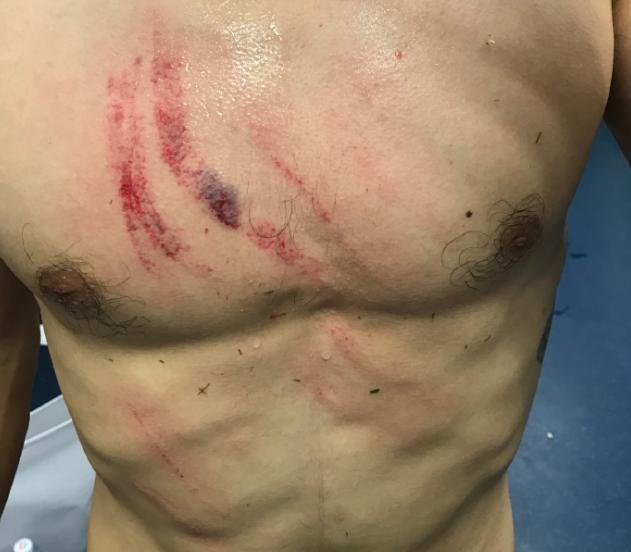 上港逃过红牌点球后轰然倒地,上海上港守门员受伤