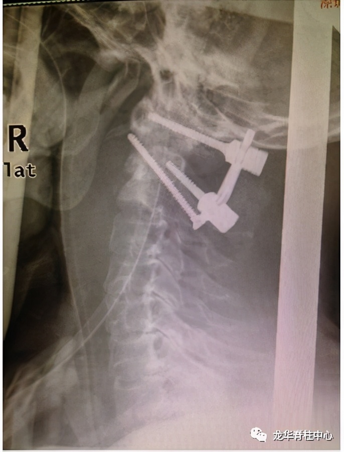 深圳市龙华区人民医院脊柱外科简介