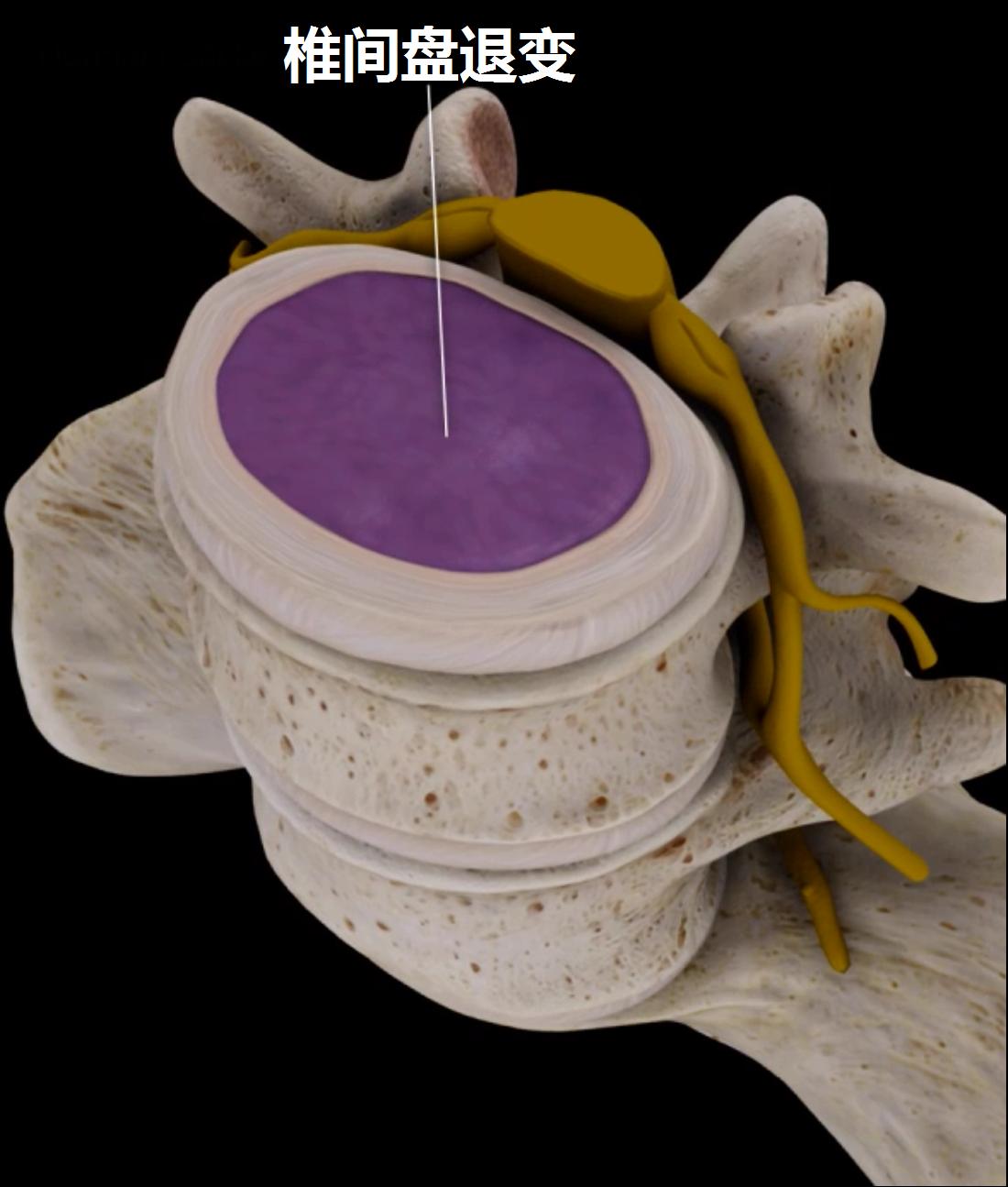 上班族该怎么预防腰痛,腰痛要警惕四种原因及治疗方法