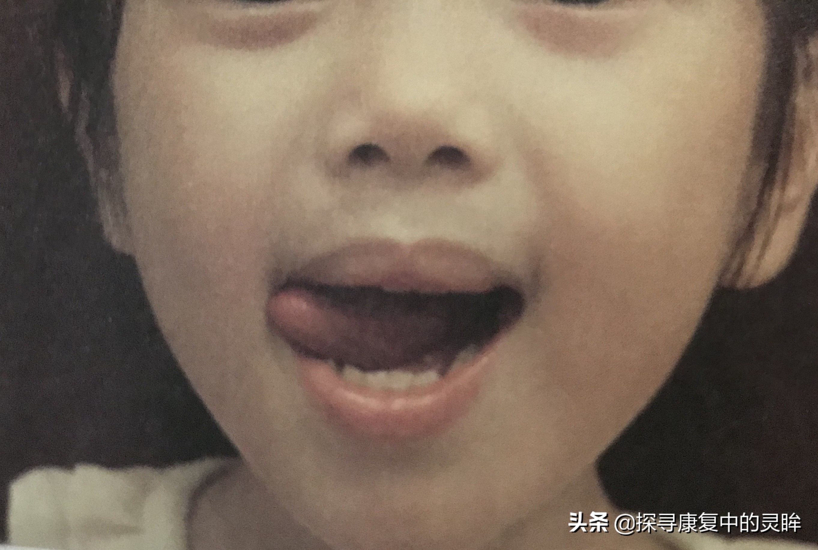 五种口部运动：灵活孩子的樱桃小嘴，让他们说话更清晰（超简单）