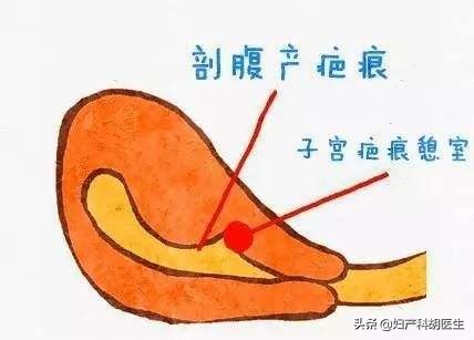 大姨妈才是19天来正常吗,大姨妈来了不痛真的正常吗