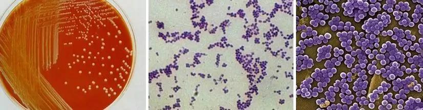 猪得葡萄球菌皮肤病,葡萄球菌引起的猪渗出性皮炎