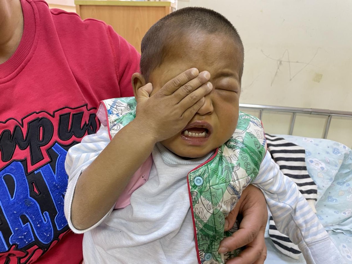 刚出生的小孩要换肝是什么病,小孩出生一星期眼睛黄