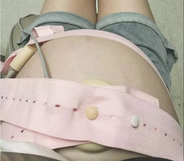 想顺产必须做好这两点,孕晚期多走路真的有助于顺产吗