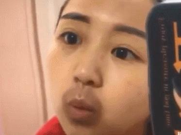 谁说在嘴上拔罐可以治牙疼,拔罐妹子治牙疼