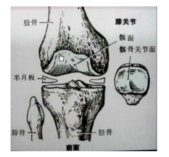 半月板损伤是无法治愈的，那么女性长期穿高跟鞋，会伤半月板吗？