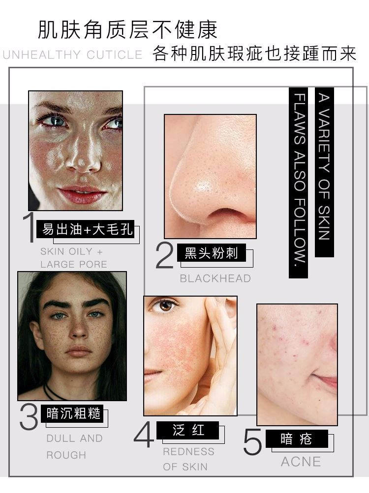 王源抽烟的相关事件引爆网络,王源在抽烟事件后的状况