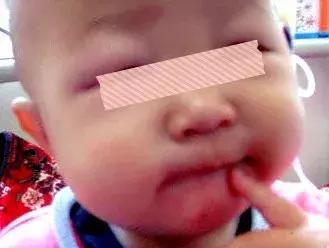 宝宝尿起泡沫是什么原因,宝宝出现泡沫便是什么原因