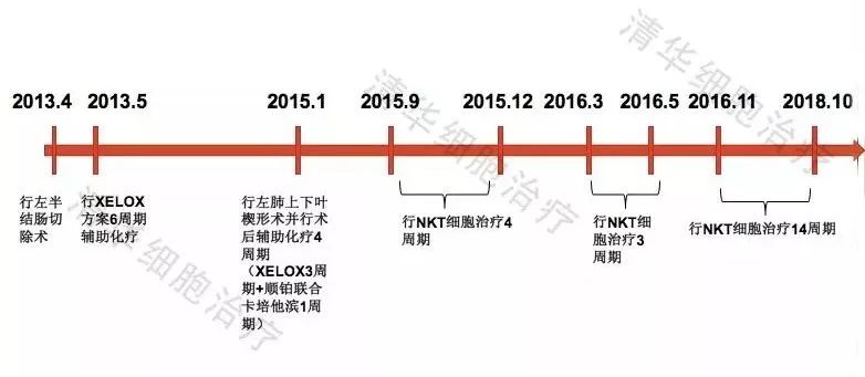 nkt治疗对什么肿瘤有效,nkt治疗适合哪种癌症