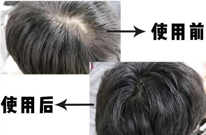 蒙古洗发水,日本洗发水蒙琉怎么样