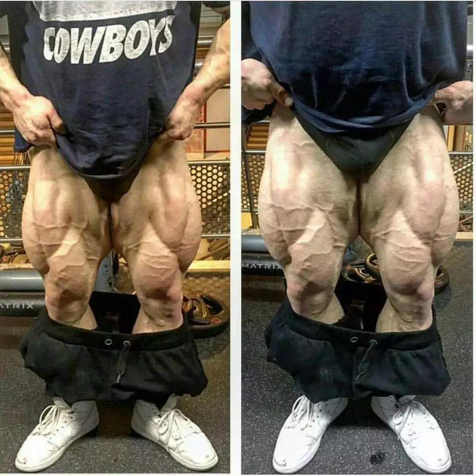 改善腿型的腿部运动,腿部拉伸矫正xo型腿